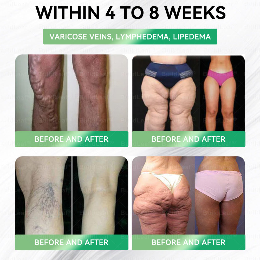 Official Store | BuildLeafยฎ GLP-1 8-in-1 Slim & Healthy Oral Solution (Once a day, results in 7 days), With 100 Billion CFU Active Probiotics โ
For obesity, abdominal bloating, sagging skin, diabetes, low energy, gut health, joint issues, and more