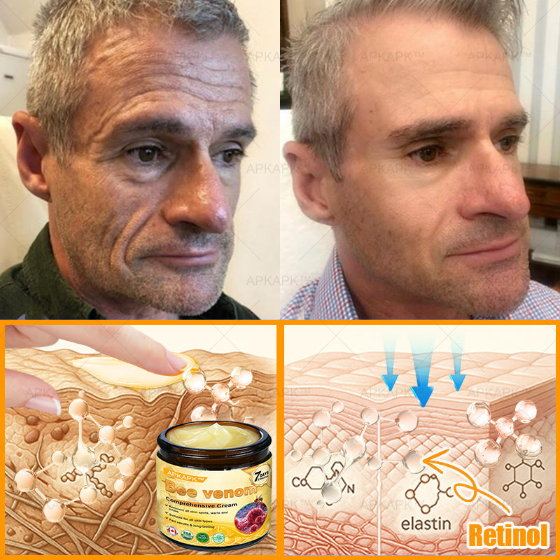 Made and Shipped from CA✨ APKAPK® Bee Venom Skin Restoration Cream🔥 LAST DAY 80% OFF 💎💎 Powerful anti-aging solution that targets deep wrinkles, fine lines, sagging skin, uneven tone, and dryness