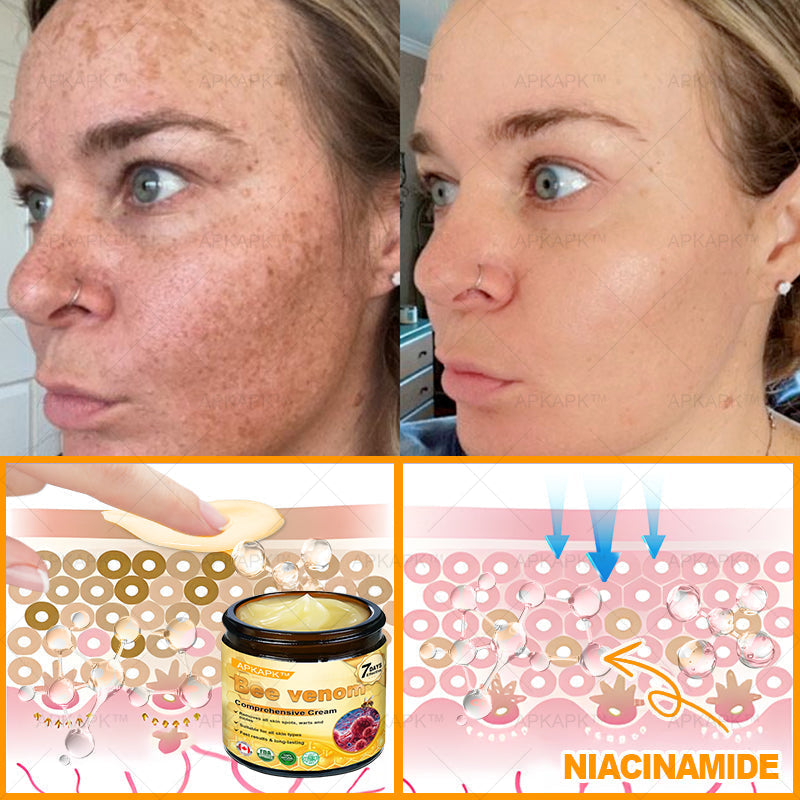 Made and Shipped from CA✨ APKAPK® Bee Venom Skin Restoration Cream🔥 LAST DAY 80% OFF 💎💎 Powerful anti-aging solution that targets deep wrinkles, fine lines, sagging skin, uneven tone, and dryness