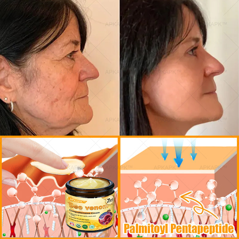 Made and Shipped from CA✨ APKAPK® Bee Venom Skin Restoration Cream🔥 LAST DAY 80% OFF 💎💎 Powerful anti-aging solution that targets deep wrinkles, fine lines, sagging skin, uneven tone, and dryness