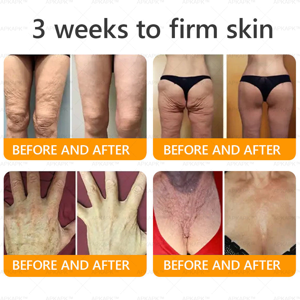 Made and Shipped from CA✨ APKAPK® Bee Venom Skin Restoration Cream🔥 LAST DAY 80% OFF 💎💎 Powerful anti-aging solution that targets deep wrinkles, fine lines, sagging skin, uneven tone, and dryness