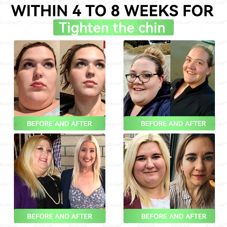 Official Store | BuildLeafยฎ GLP-1 8-in-1 Slim & Healthy Oral Solution (Once a day, results in 7 days), With 100 Billion CFU Active Probiotics โ
For obesity, abdominal bloating, sagging skin, diabetes, low energy, gut health, joint issues, and more