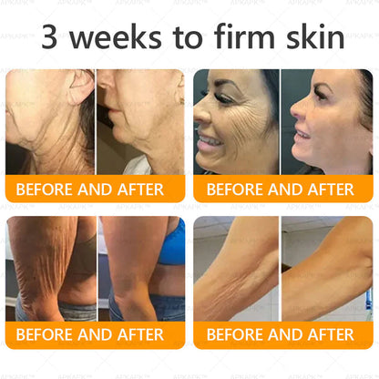 Made and Shipped from CA✨ APKAPK® Bee Venom Skin Restoration Cream🔥 LAST DAY 80% OFF 💎💎 Powerful anti-aging solution that targets deep wrinkles, fine lines, sagging skin, uneven tone, and dryness