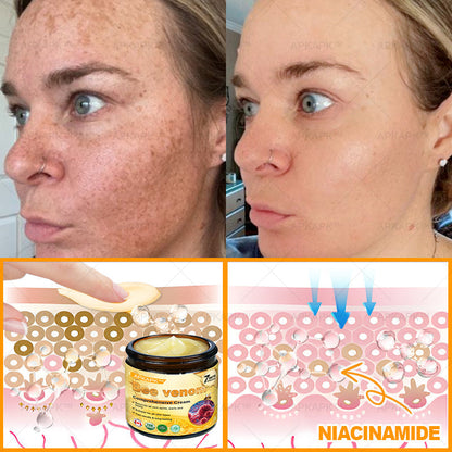 Made and Shipped from CA✨ APKAPK® Bee Venom Skin Restoration Cream🔥 LAST DAY 80% OFF 💎💎 Powerful anti-aging solution that targets deep wrinkles, fine lines, sagging skin, uneven tone, and dryness