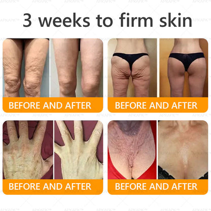 Made and Shipped from CA✨ APKAPK® Bee Venom Skin Restoration Cream🔥 LAST DAY 80% OFF 💎💎 Powerful anti-aging solution that targets deep wrinkles, fine lines, sagging skin, uneven tone, and dryness